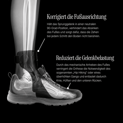 Cedrow Foot Drop AFO Brace - Althea